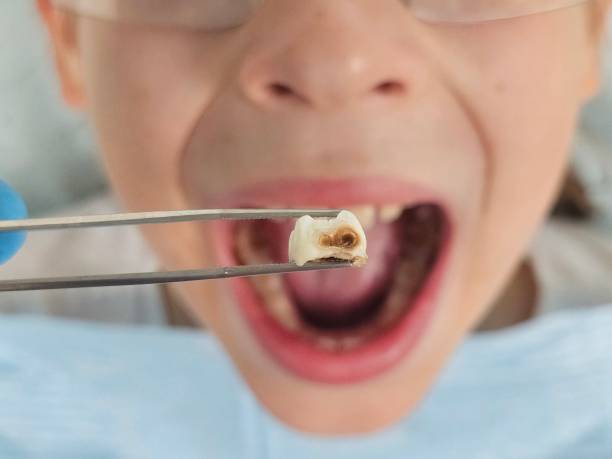 Best Emergency Care for Gum Disease in Gateway, AK